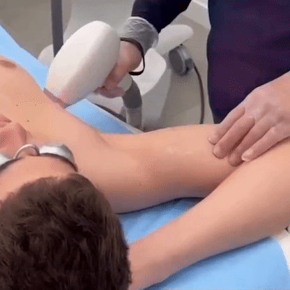 Depilación láser Margiestetic