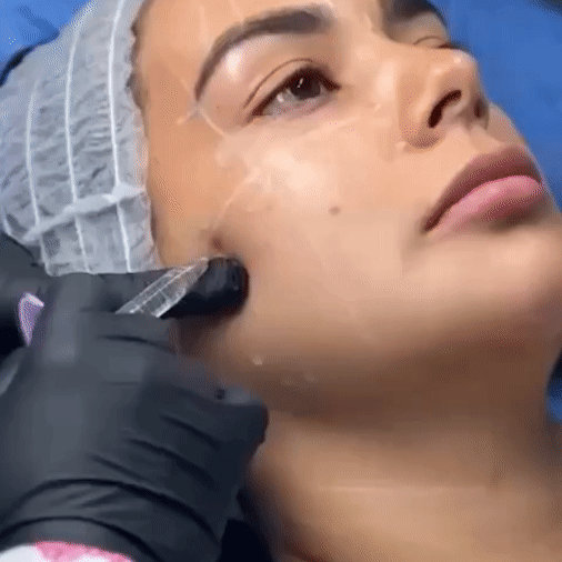 Full face Margiestetic