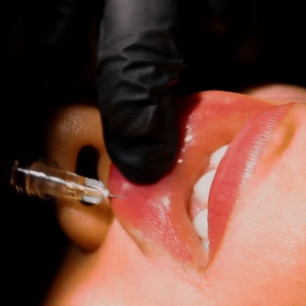 Labios perfectos Margiestetic