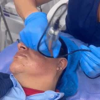 Nanopore Margiestetic