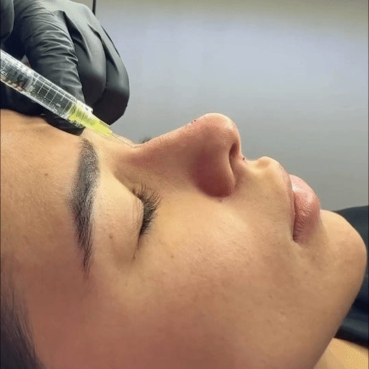 Rinomodelacion Margiestetic