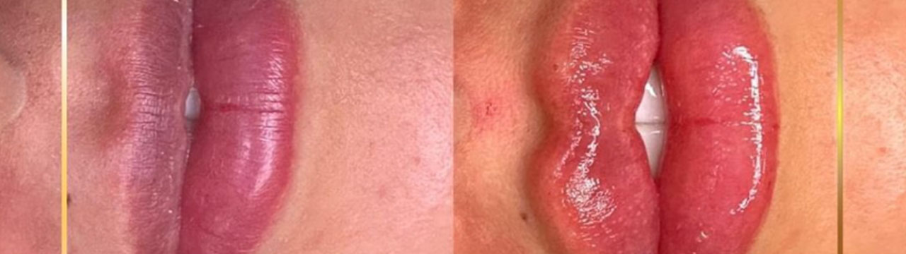 Labios perfectos Margiestetic